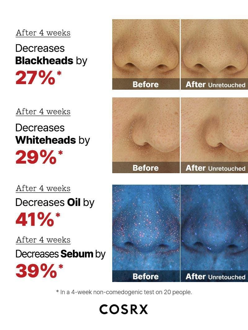 COSRX The AHA 2 BHA 2 Blemish Treatment Serum