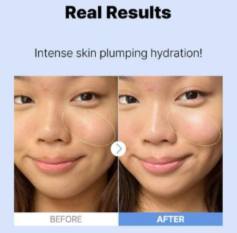 COSRX The Hyaluronic Acid 3 Serum
