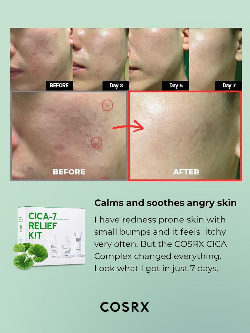 COSRX CICA-7 RELIEF KIT- 3 step