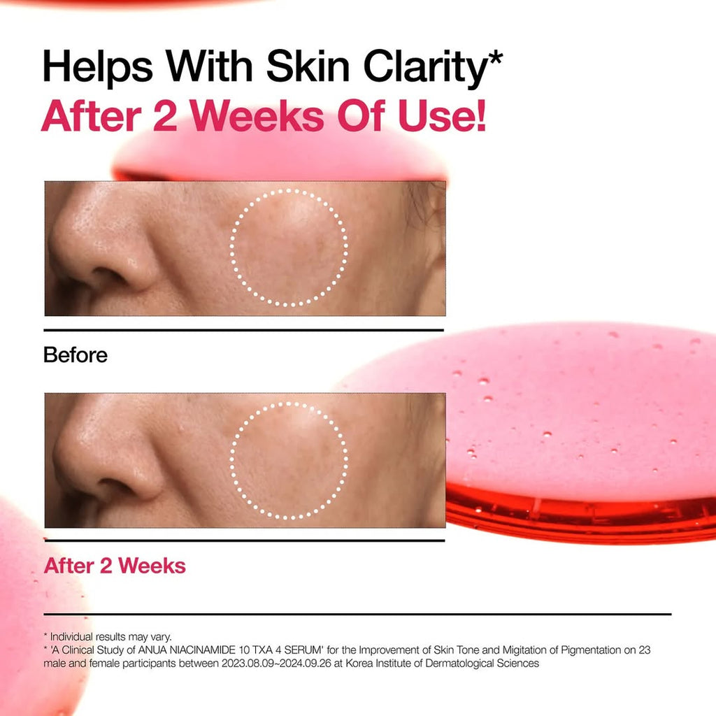 Anua Niacinamide 10 + TXA 4