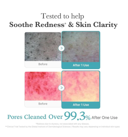 Medicube Azelaic Acid Niacinamide Deep Clean Foam Cleanser